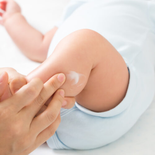 Cómo hidratar la piel del bebé recién nacido